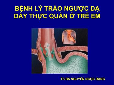 Bài giảng Bệnh lý trào ngược dạ dày thực quản ở trẻ em - Nguyễn Ngọc Rạng