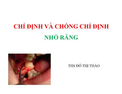 Bài giảng Chỉ định và chống chỉ định nhổ răng - Đỗ Thị Thảo