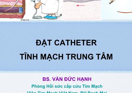 Bài giảng Đặt Catheter tĩnh mạnh trung tâm - Văn Đức Hạnh