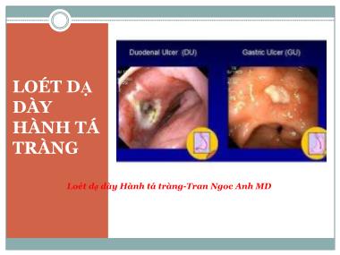 Bài giảng Loét dạ dày hành tá tràng - Trần Ngọc Ánh